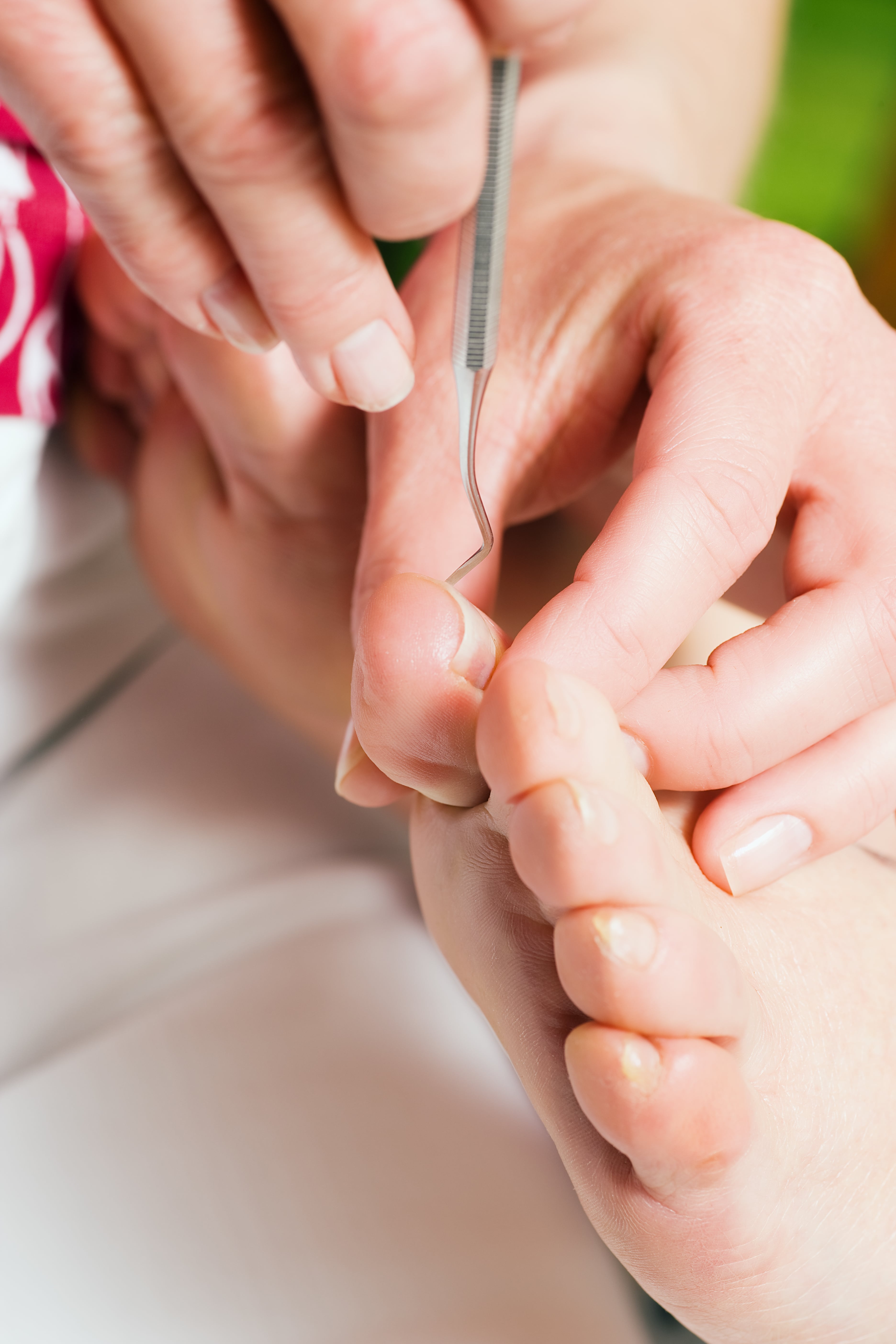 A photograph of a nail treatment